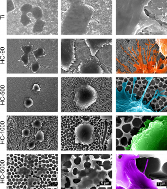 
	- Material surface morphologies of different samples under scanning electron microscope examination, including flat Ti, nano-structure in 90nm, 500nm, 1000nm and 5000nm
	
	- Cellular morphologies of macrophages on different sample surface (scale bars, 10 μm (first column), 5 μm (second column) and 1 μm (third column))
	
	-  The cells on 90nm surface extended more “legs” (filopodia) than those on 500nm, 1000nm and 5000nm.

